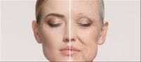Can Alcohol Age Your Skin Faster? Expert Weighs In